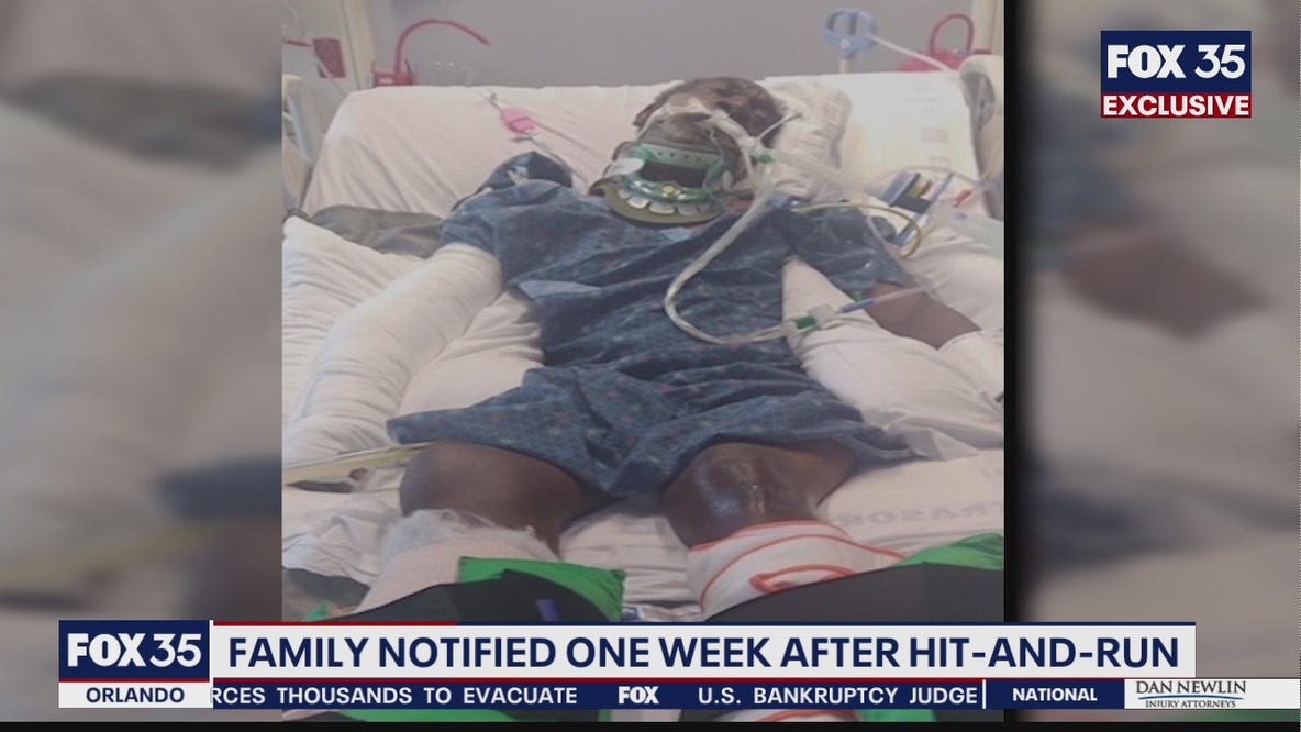 Man, 73, critical after hit and run in Poinciana